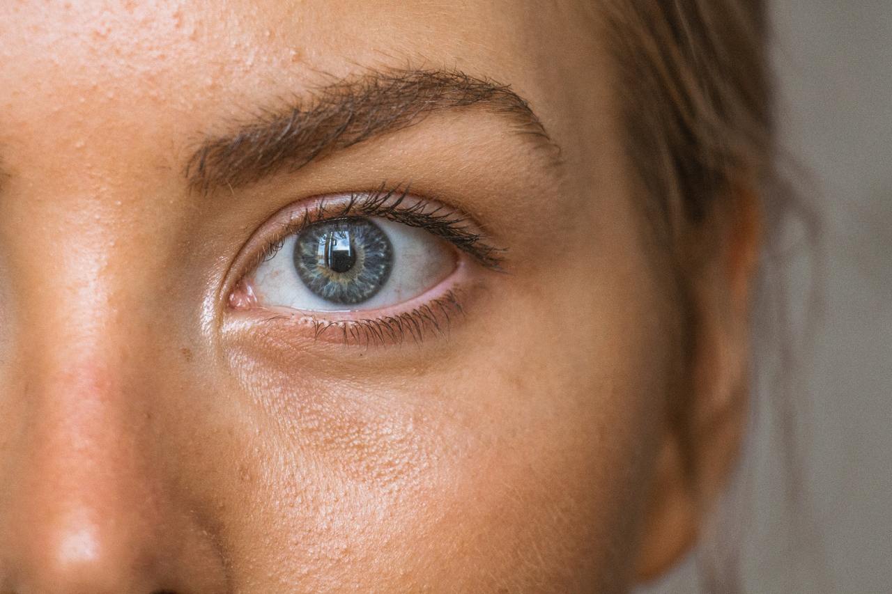 Beat the Grease: Natural Ways to Control Oily Skin