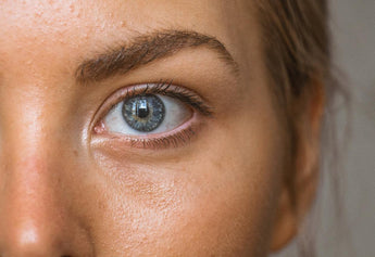 Beat the Grease: Natural Ways to Control Oily Skin