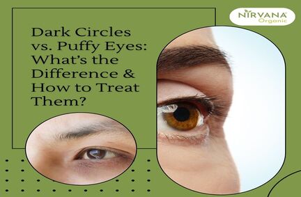 Dark Circles vs. Puffy Eyes: What’s the Difference & How to Treat Them?