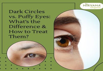 Dark Circles vs. Puffy Eyes: What’s the Difference & How to Treat Them?