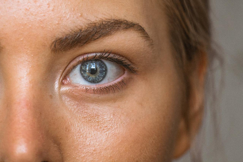 Beat the Grease: Natural Ways to Control Oily Skin